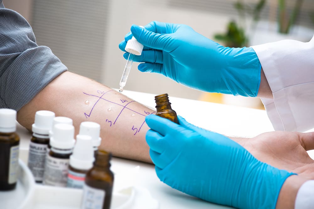 Allergy Testing in Madison, AL