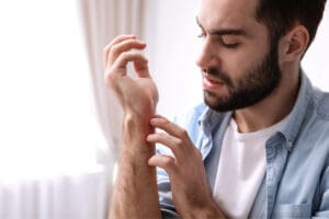Can Stress Cause Eczema? Understanding the Connection and How to Find Relief